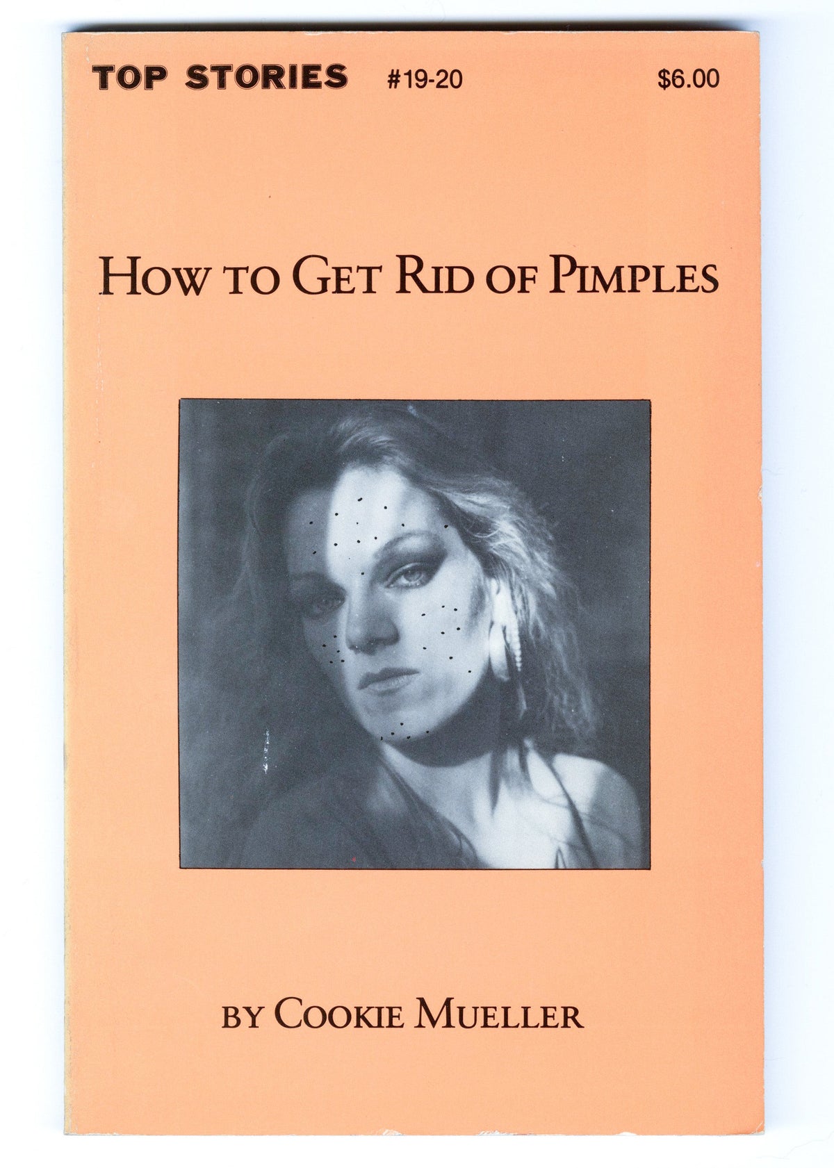 MUELLER, Cookie. How to Get Rid of Pimples.